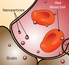 Nanotechnology used in the medical field